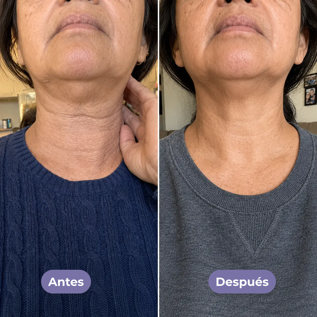 Crema para el cuello