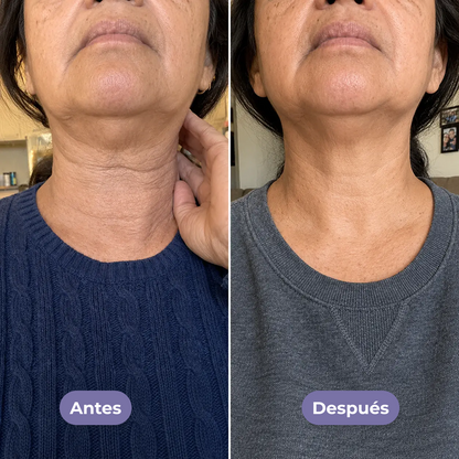 Crema para el cuello
