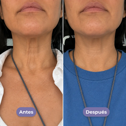 Crema para el cuello