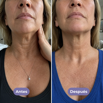 Crema para el cuello